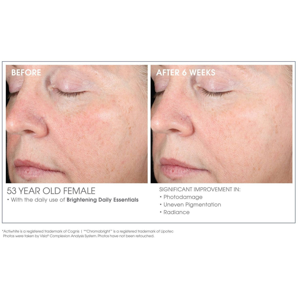 Glowbiotics Advanced Vitamin C Brightening Serum - askderm