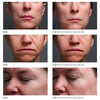 SilcSkin Multi Set Facial Pads - askderm