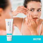 eraclea acne clearing treatment - askderm